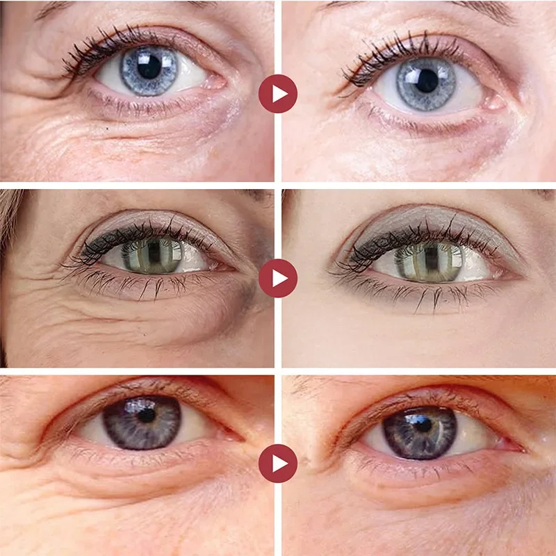 Rugas remover os olhos remendo - Sheet Mask Collagen avaliação e preço